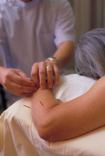 ANTA Natural Therapies Acupuncture